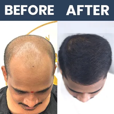 Bio Sapphire Result 01