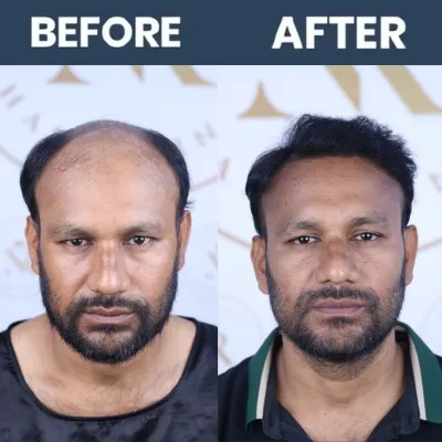 Bio sapphire Result 03