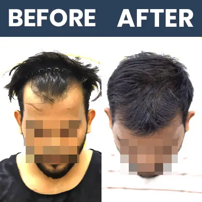 DHI Result 01 - Mar 2025