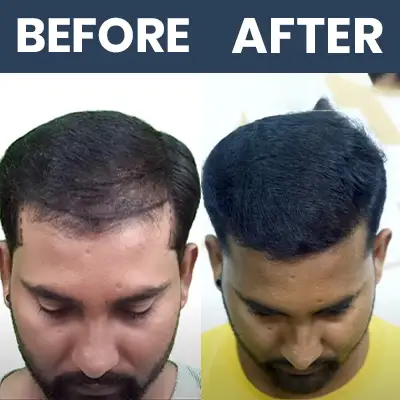 DHI Result 03 - Mar 2025