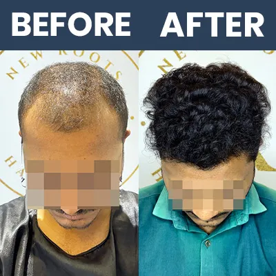 HT Result 02 - Mar 2025