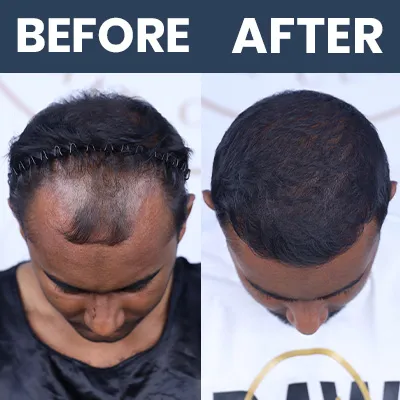 HT Result 04 - Mar 2025