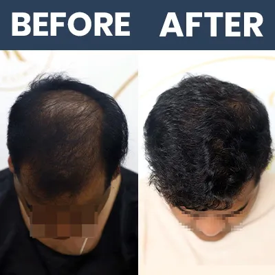 HT Result 06 - Mar 2025